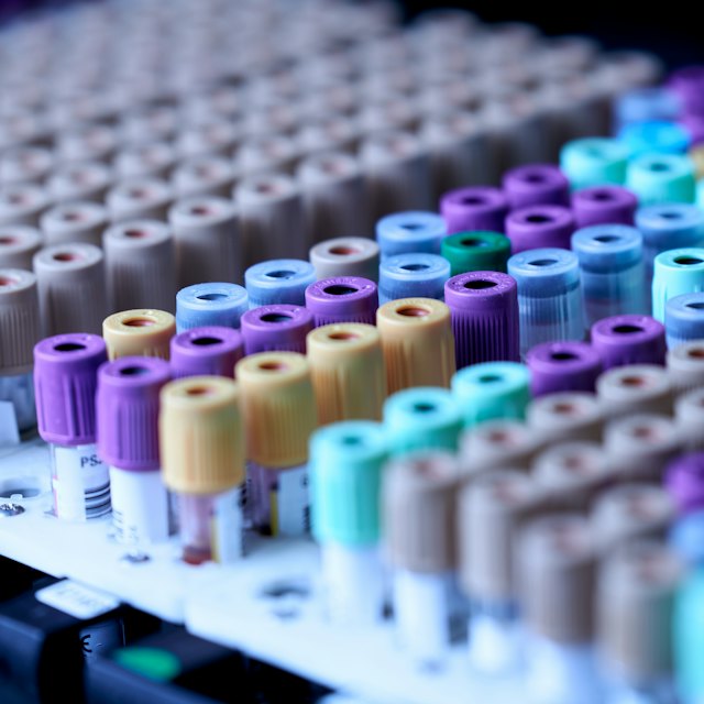 Sample tubes in a laboratory rack